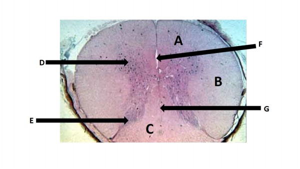 <p>E</p>