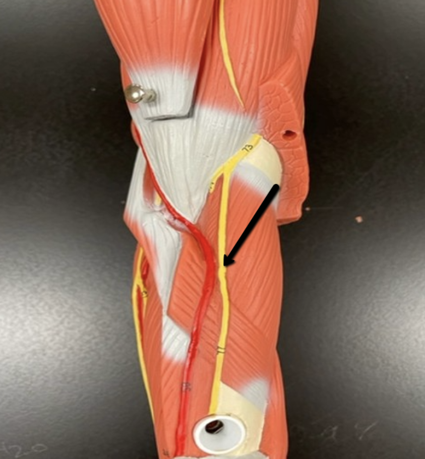 <p><span>Identify the nerve/cord indicated by the pointer.</span></p>
