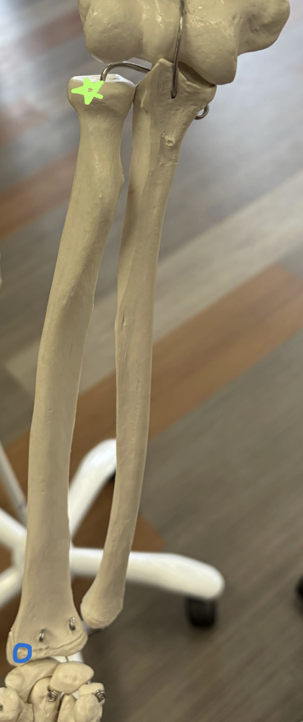 <p>What is this bone?</p><p>Green star: What is this structure?</p><p>Blue circle: What is this structure?</p><p>Which bone presses against the blue circle and what ligament attaches here? </p>