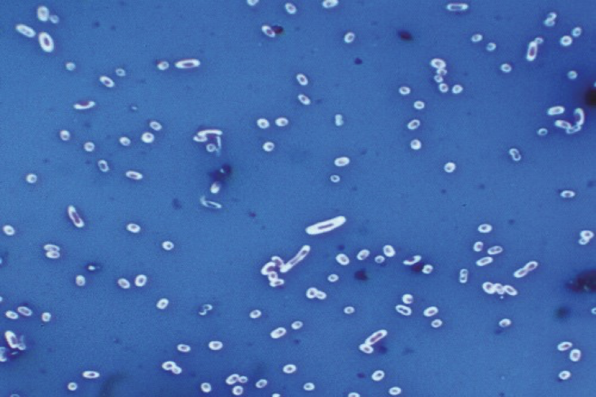<p>Klebsiella pneumoniae transmission route</p>