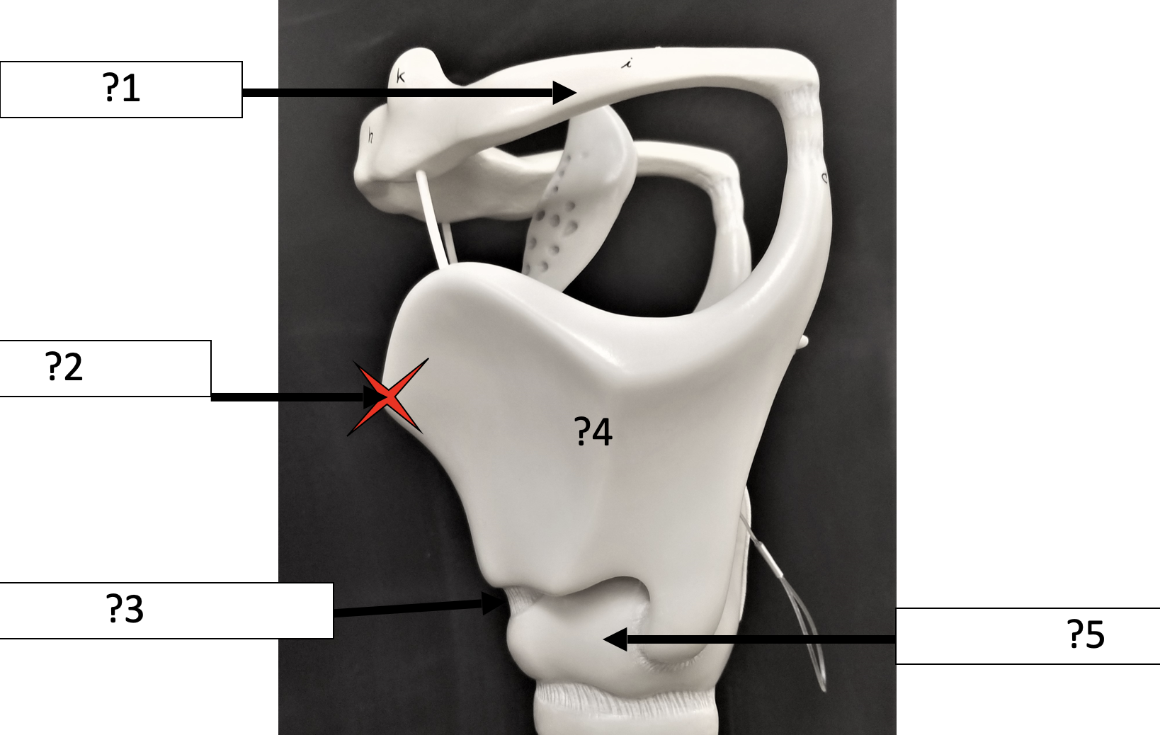 <p>1 Name the bone?</p>