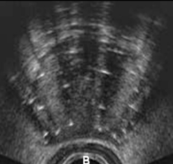 <p>Identify this image. </p>