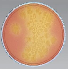 <p>Selectief (<em>en electief</em>) </p><p>Selectieve stoffen: cycloserine en cefoxitine (antibiotica) → remmen de groei van veel andere darmbacteriën </p><p><em>Electieve stoffen: fructose → fermentatie van fructose </em></p><p>Groei van Clostridium difiicile </p><ul><li><p>Clostridium difficile fermenteert fructose → zure eindproducten → verzuring → gele verkleuring medium (gele kolonies) </p></li></ul><p><strong>Anaeroob</strong></p>