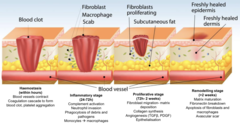 <p>- Haemostasis,</p><p>- Inflammatory (early, late)</p><p>- Proliferative</p><p>- Remodeling</p>