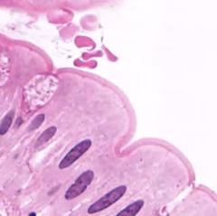 <p>apical specialization</p>
