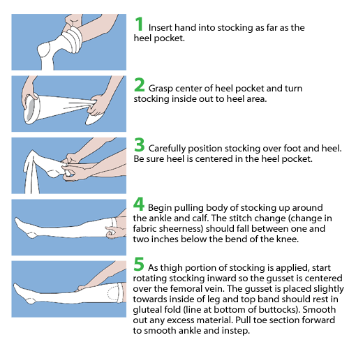 <p>Step 3 of Skill: After exposing one leg</p>