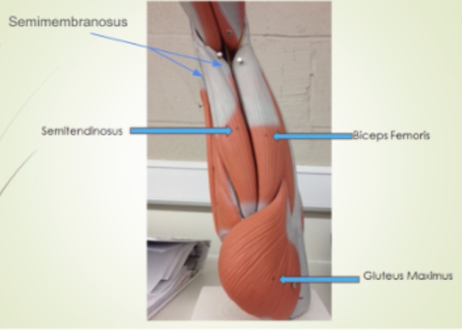 <p><span style="background-color: transparent;">Biceps Femoris, </span><span style="background-color: transparent; font-family: "Times New Roman", serif;">Gluteus Maximus, </span><span style="background-color: transparent;">Semitendinosus, </span><span style="background-color: transparent; font-family: "Times New Roman", serif;">Semimembranosus</span></p>