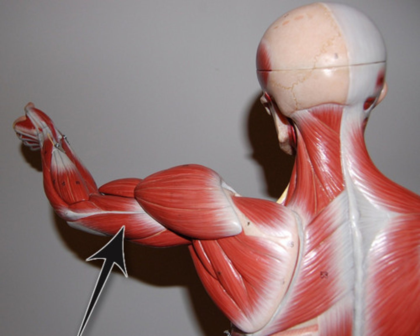 <p>Origin: infraglenoid tubercle of scapula</p><p>Insertion: olecranon</p><p>Action: elbow extension</p>
