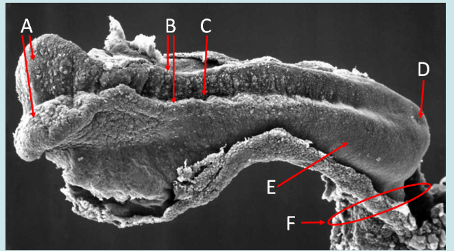 <ol><li><p>Label A, B, C, D, E and F</p></li><li><p>What view is this?</p></li></ol><p></p>