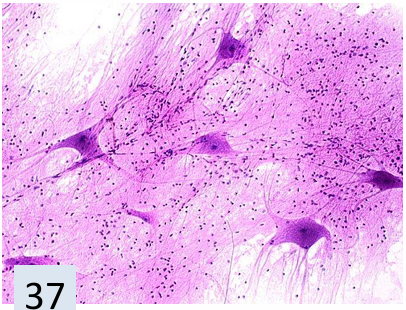 <p>what tissue is this?</p>