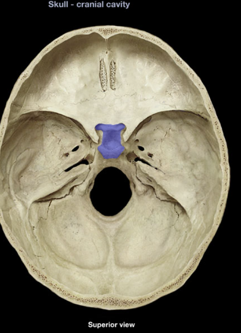 term image