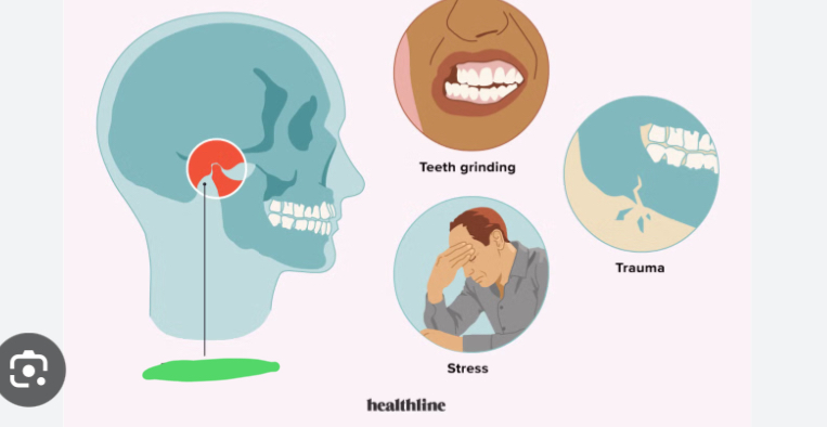 <p>What is this photo describing? What is it caused by?</p>