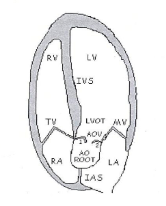 <p><span>Apical 5 Chamber (Ap5ch) Diagram </span></p>