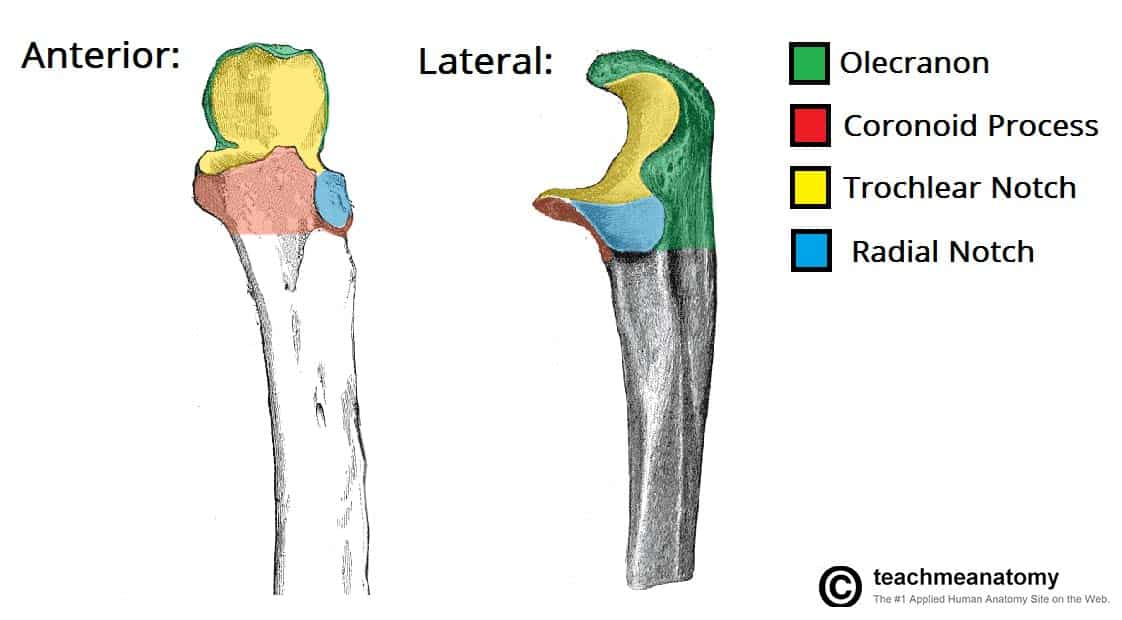 <p>Radial Notch</p>