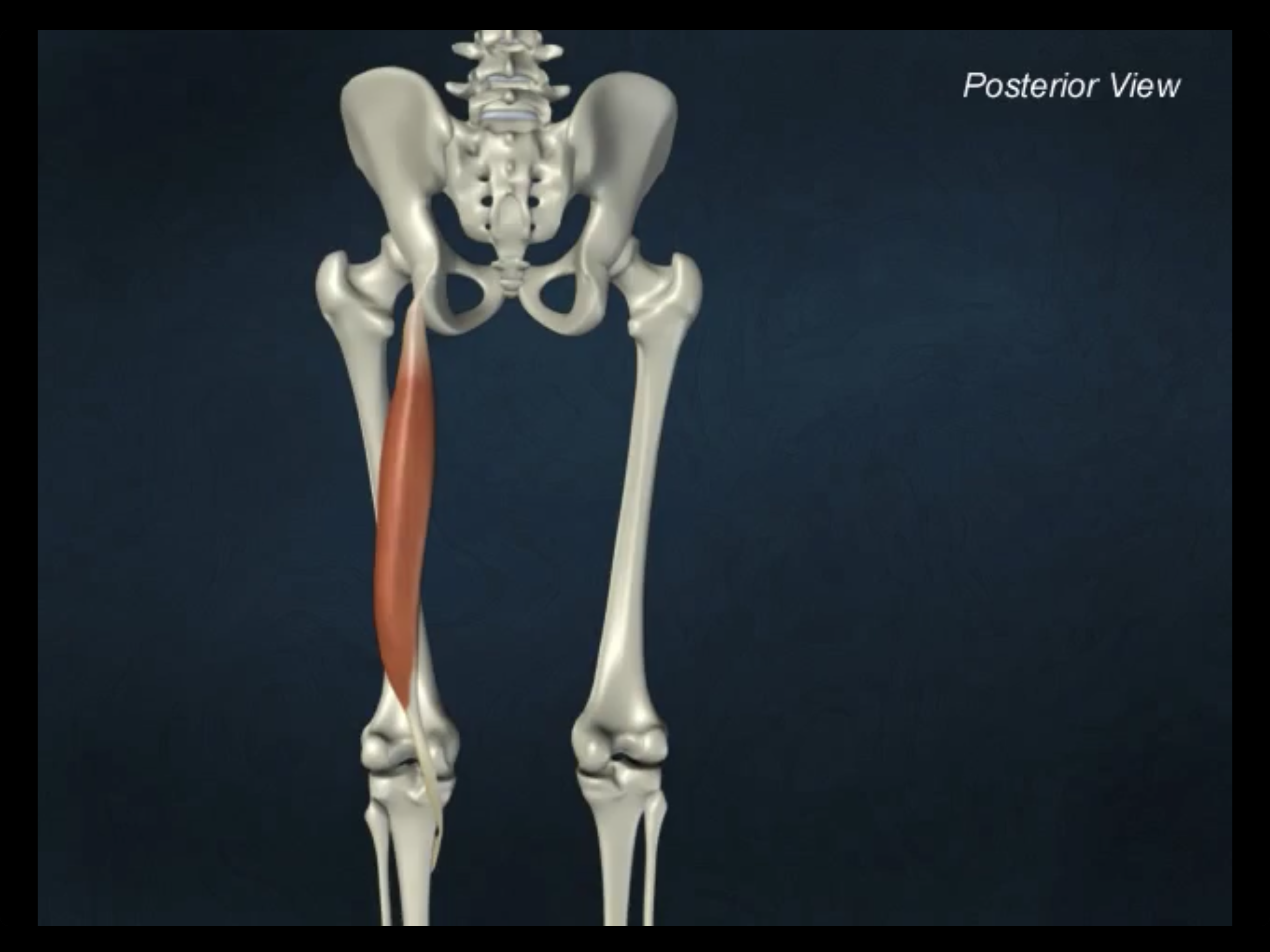 <p>ischial tuberosity</p>