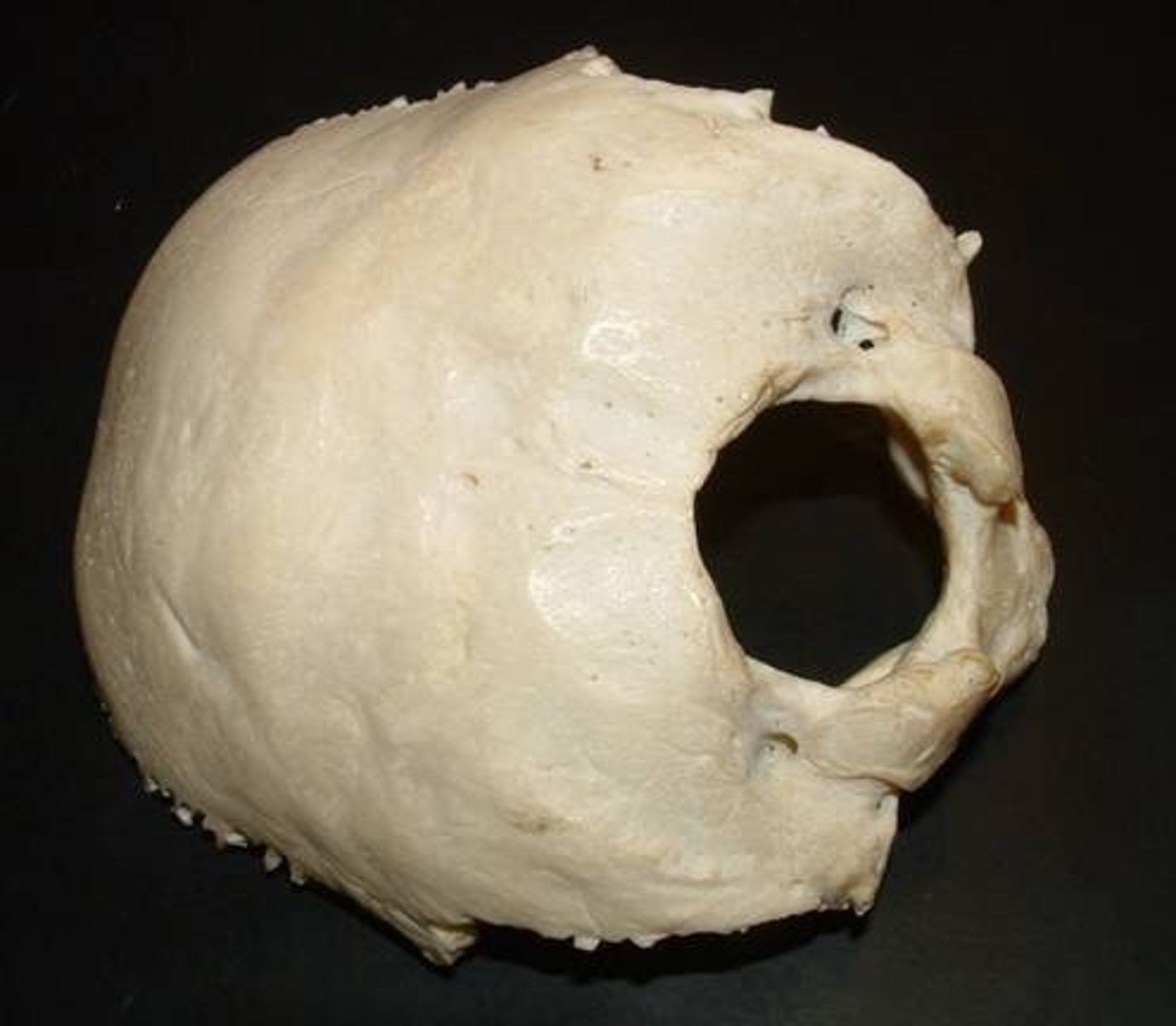 <p>Name this bone.</p>