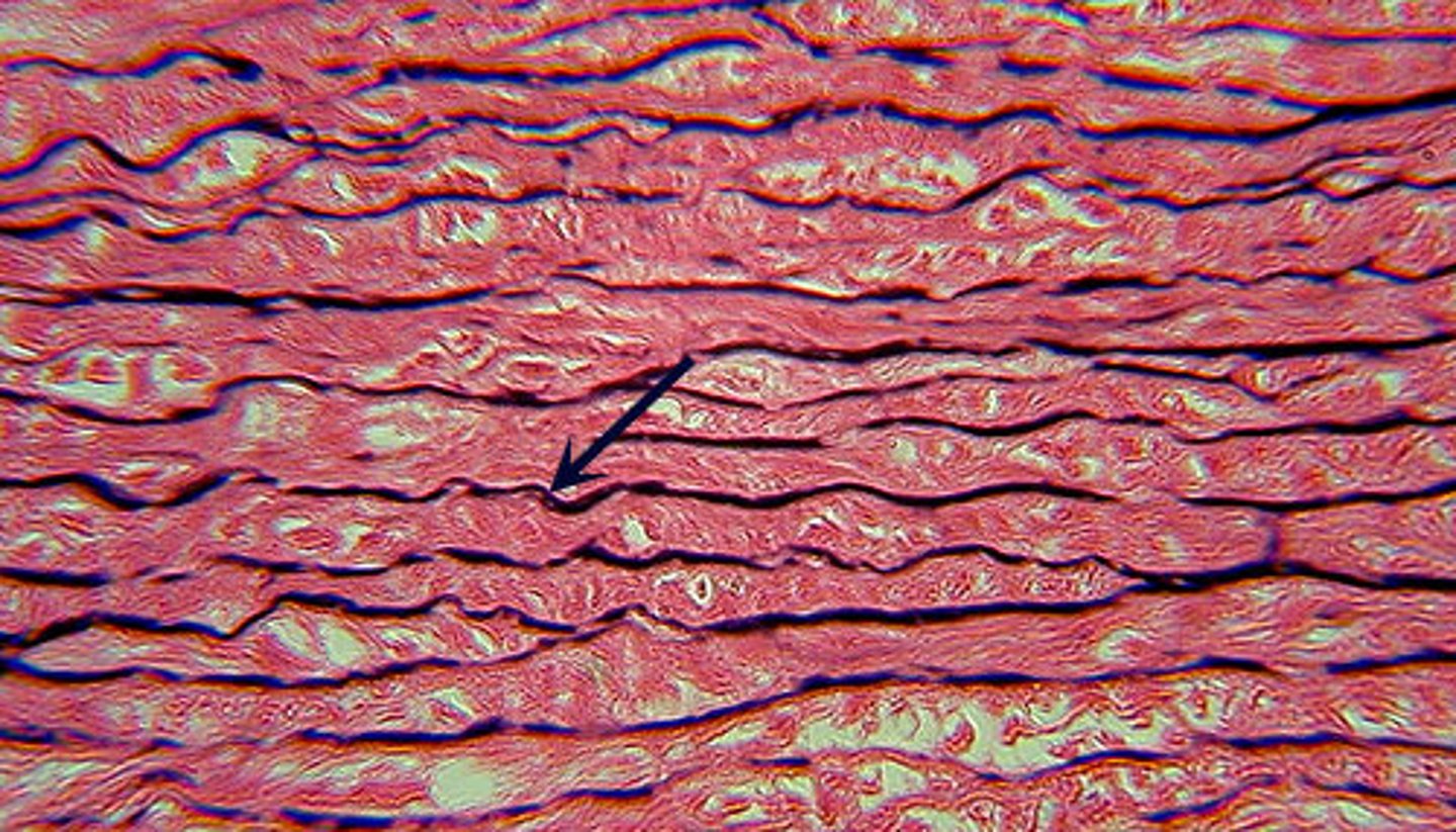<p>Dense Elastic Connective Tissue</p>