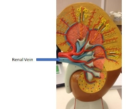 <p>renal vein</p>
