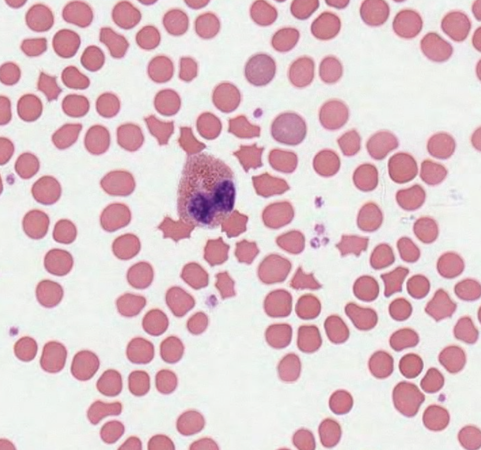 <p>What type of immune cell is pictured in the slide? (Porcine Blood)</p>