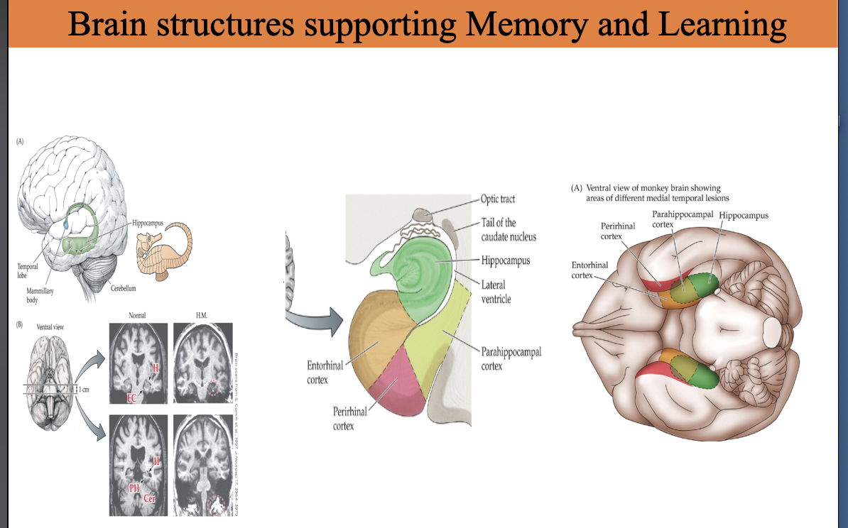 <ul><li><p><span><strong>Hippocampus</strong> – essential for forming new declarative memories</span></p></li><li><p><span><strong>Entorhinal cortex (EC)</strong> – major input/output gateway to the hippocampus</span></p></li><li><p><span><strong>Perirhinal cortex (PRC)</strong> – object recognition memory</span></p></li><li><p><span><strong>Parahippocampal cortex (PHC)</strong> – spatial/context memory</span></p></li><li><p><span><strong>Mammillary bodies</strong> – part of the Papez circuit</span></p></li><li><p><span><strong>Temporal lobe</strong> – houses the medial temporal memory system</span></p></li><li><p><span><strong>Cerebellum</strong> – procedural learning (motor memory)</span></p></li></ul><p></p>