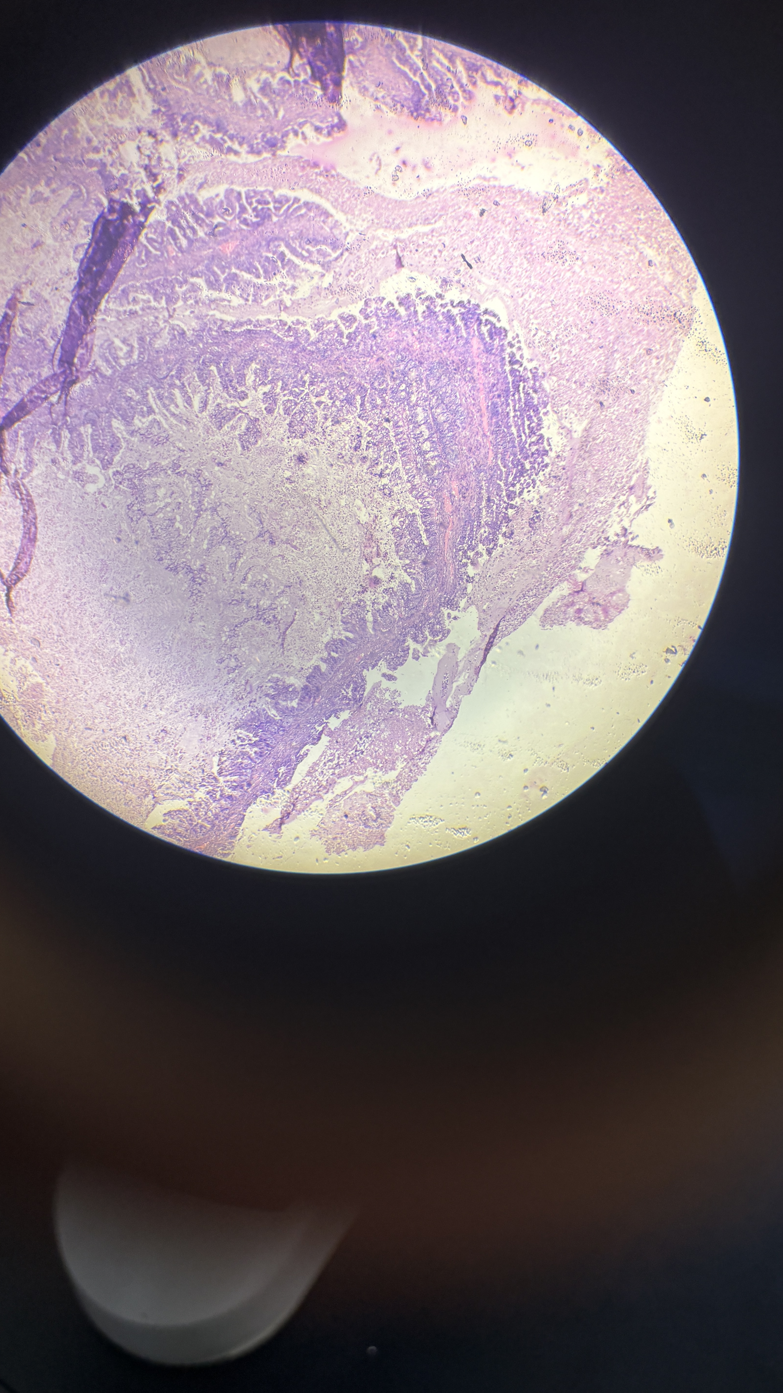 <p>What is the diagnosis?</p>