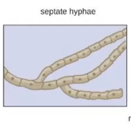 <ul><li><p>walls in between</p></li></ul><p></p>