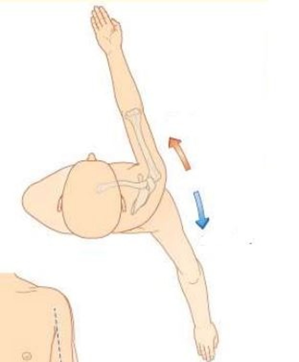 <p>Movements of the Upper Limb</p><p>What movement is this?</p>
