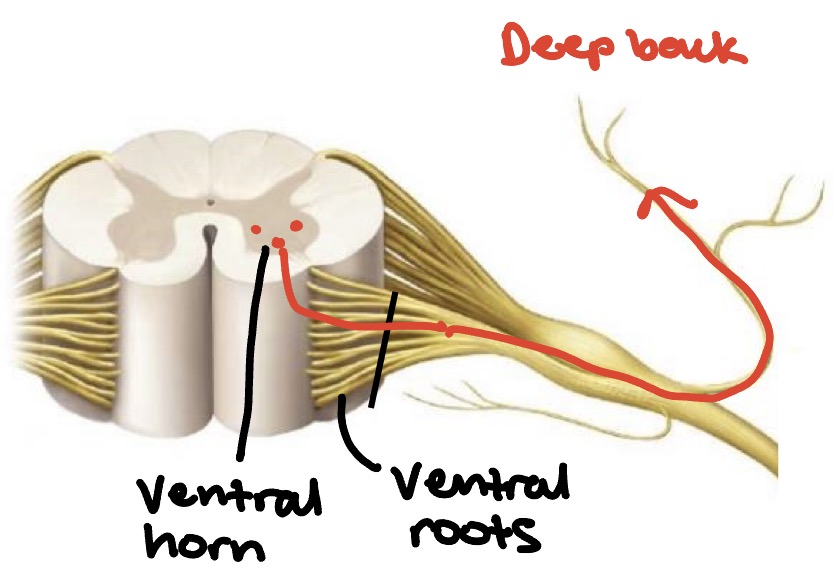 <p>What type of signal would be interrupted here?</p>