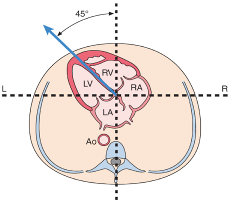 <p>left atrium (LA)</p>