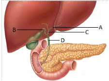 <p><span style="line-height: 17.375px;">Correctly identify the cystic duct&nbsp;</span></p>