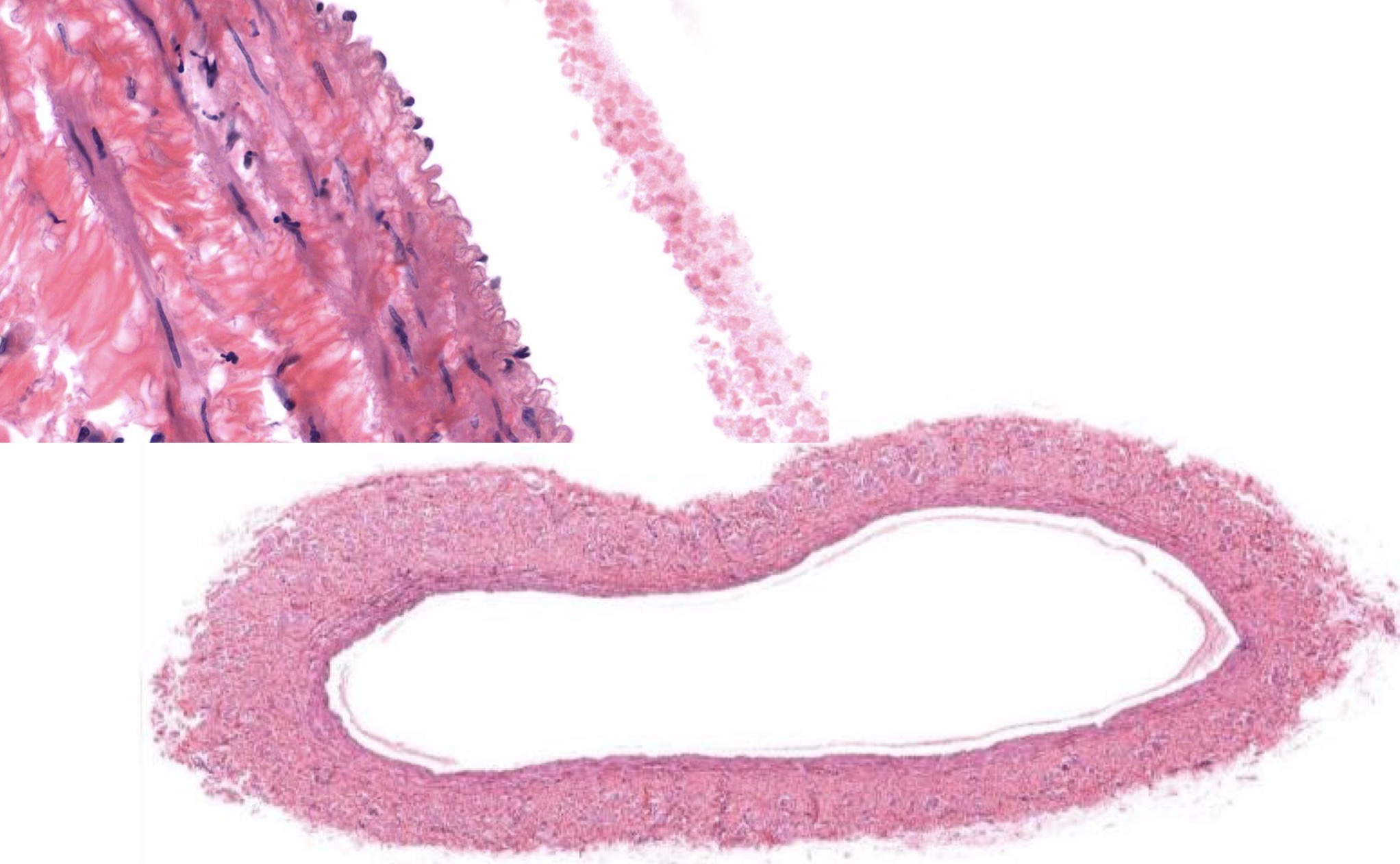 <p>Identify the Vessel and the Layer pictured</p>