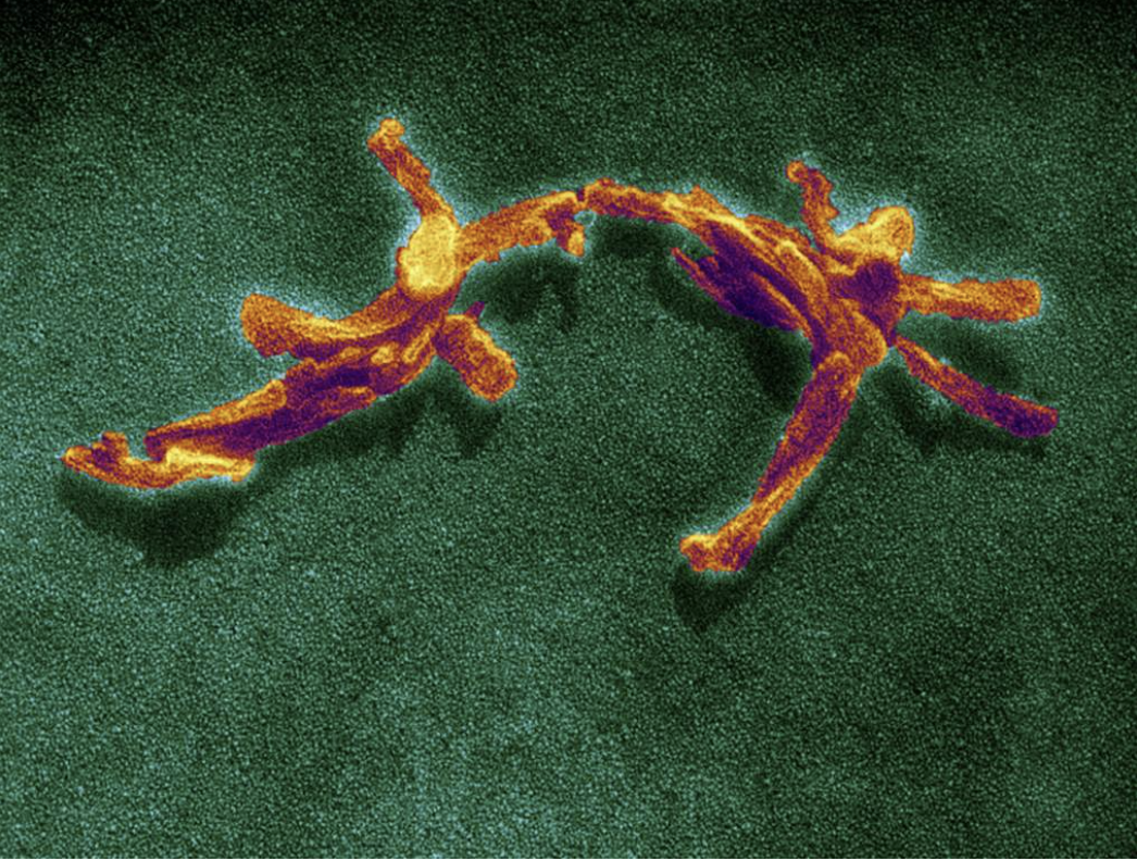 <p>Prions</p>