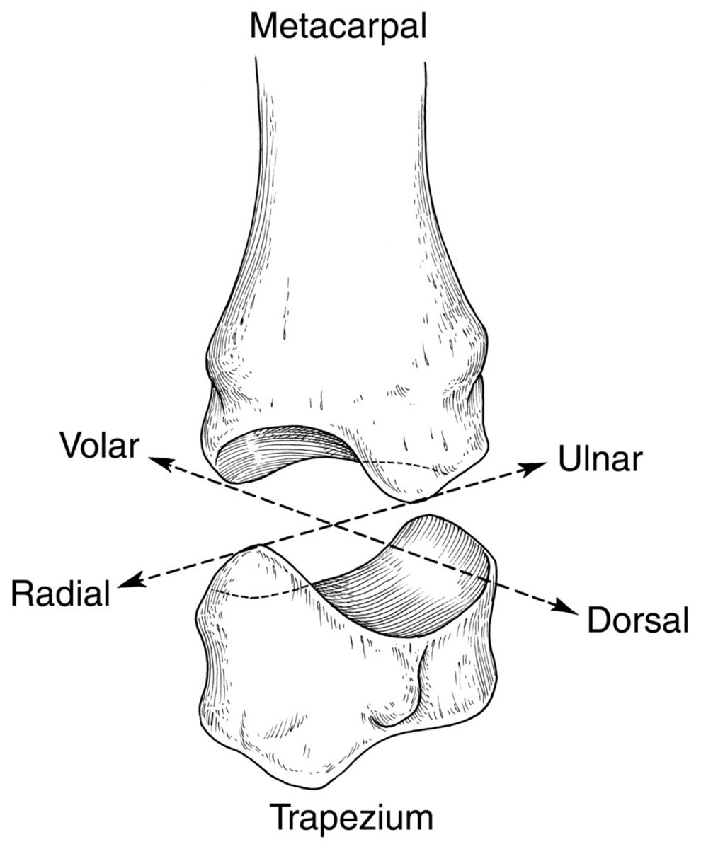 <p>(Saddle Joint)</p><p>Trapezium meets the metacarpal</p><p>-EXTREMELY MOBILE</p><p>Motions:</p><p>-Flexion/Extension</p><p>-Radial &amp; Palmar Abduction/Adduction</p><p>-Rotation</p><p>-Opposition</p><p>-Circumduction</p>