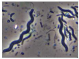 <p>Spirillum (pl. spirilla)</p>