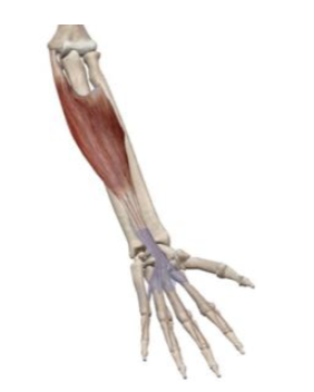 <p>what muscle and action is this </p>