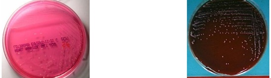 <p>This organism appears as <strong>pink</strong> on <strong>MSA plates</strong> because it <strong>does not ferment mannitol</strong> and causes <strong>gamma hemolysis</strong> on <strong>blood agar plates</strong>, which microorganism is it?</p>