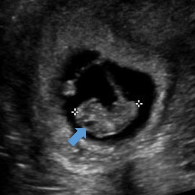 <p><span>What are we seeing in this image?</span></p>