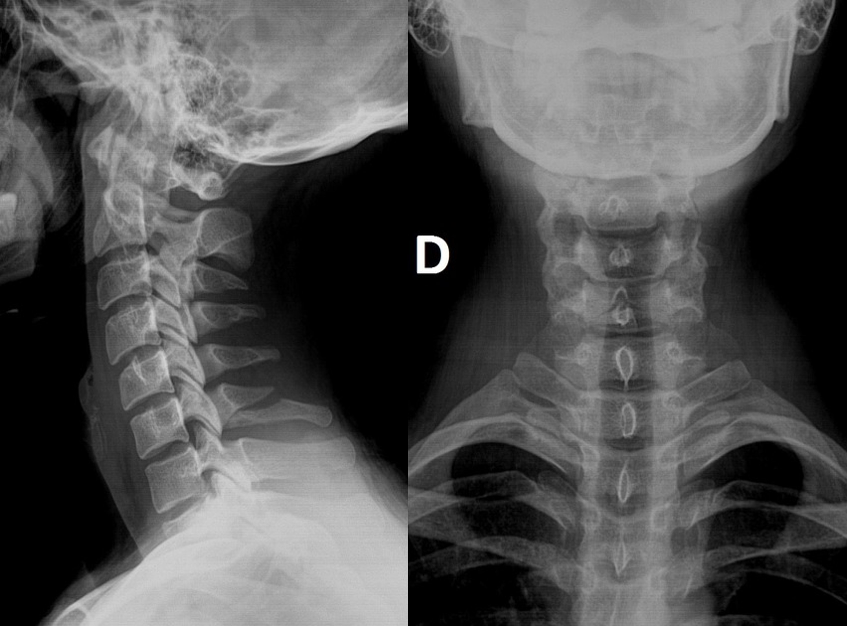 <p>What is the diagnosis?</p>