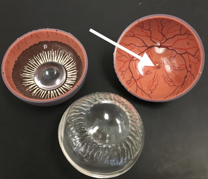 <p><span>name the LARGER CIRCLE structure at the end of the arrow's point</span></p>