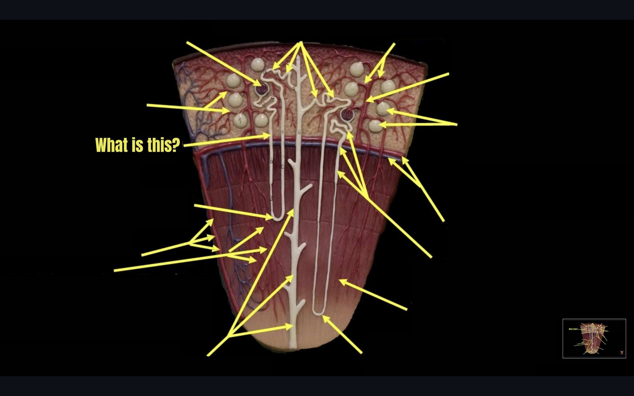 term image