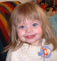 <p>Elfin-appearance, friendly, increased empathy and verbal reasoning ability.</p>