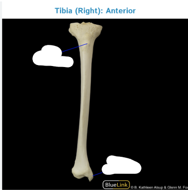 <p>wat is dit? (bovenste)</p>