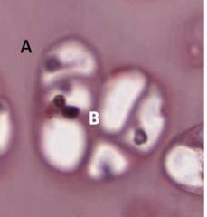 <p>Identify the type of matrix indicated by A and B.</p>