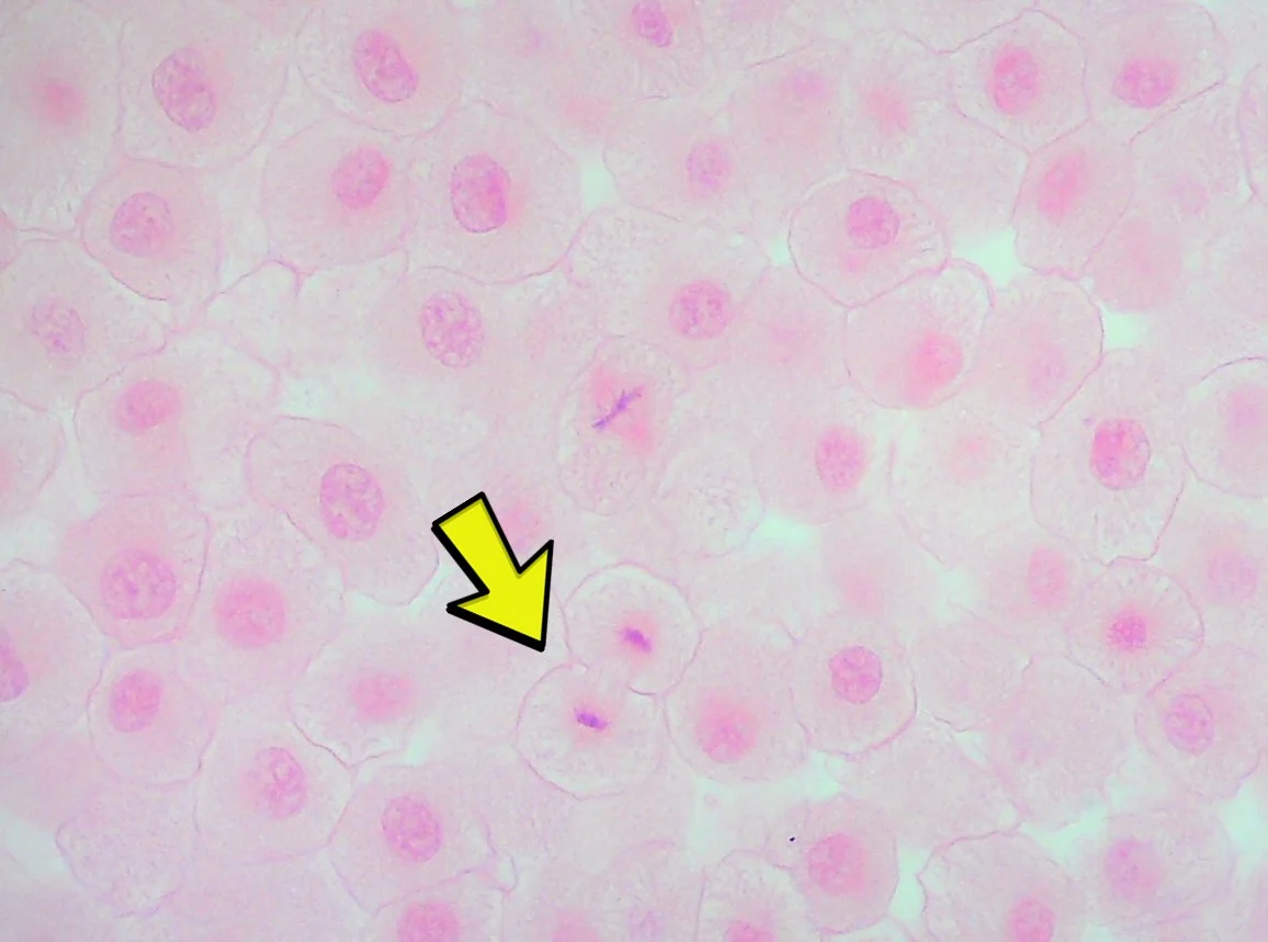<p><span>Identify the phase of mitosis occurring at the yellow arrow.</span></p>