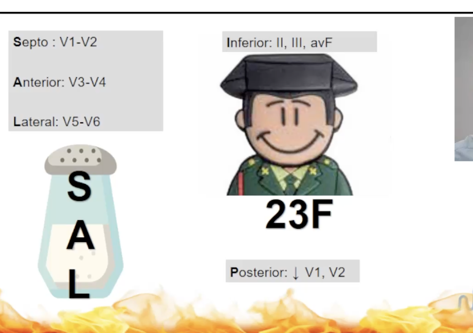 <p>Cuando tenemos un infarto inferior mirar la posterior </p><p>Dale la vuela </p>