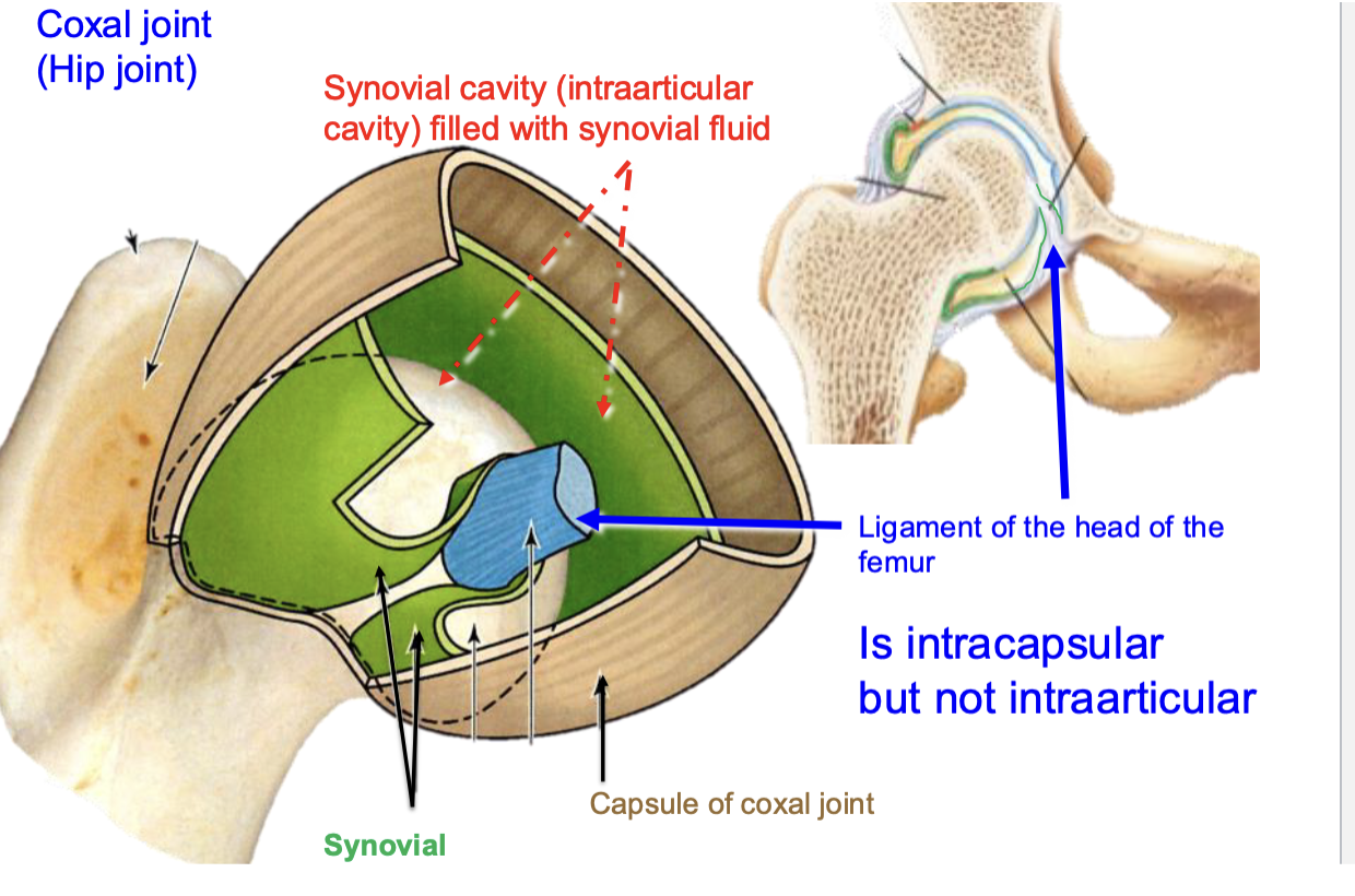 <p>intracapsular is not within the synovial cavity </p>