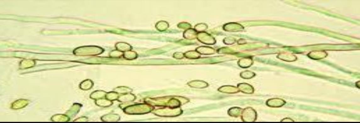 <p>Specimen (microscopically slide):</p><p>• Name of organism:</p><p>• Stain:</p><p>• Sample from: culture or pus or in tissue</p><p>• Morphology</p>