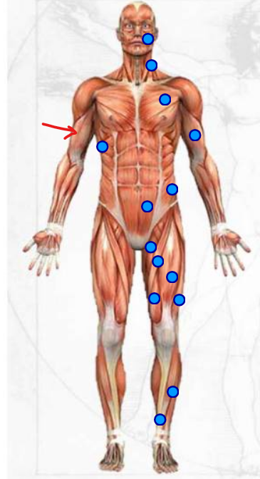 <p>muscle on the upper arm </p>