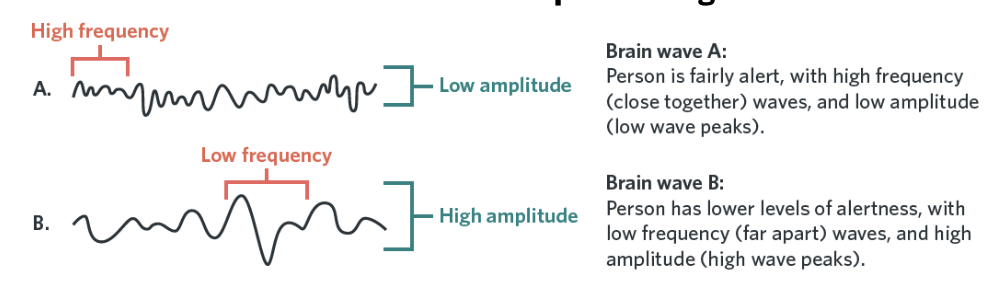 <p><span style="background-color: transparent; font-family: "Work Sans", sans-serif;">The frequency and amplitude of brain waves can indicate what state of consciousness an individual is experiencing.</span></p><ul><li><p>Frequency- rate</p></li><li><p>Amplitude- height</p></li></ul><p></p>