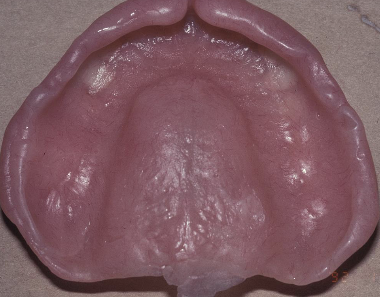 <p>Apply astron and let it set for ~10min. If you like it, cure it! If you don’t like it?</p>